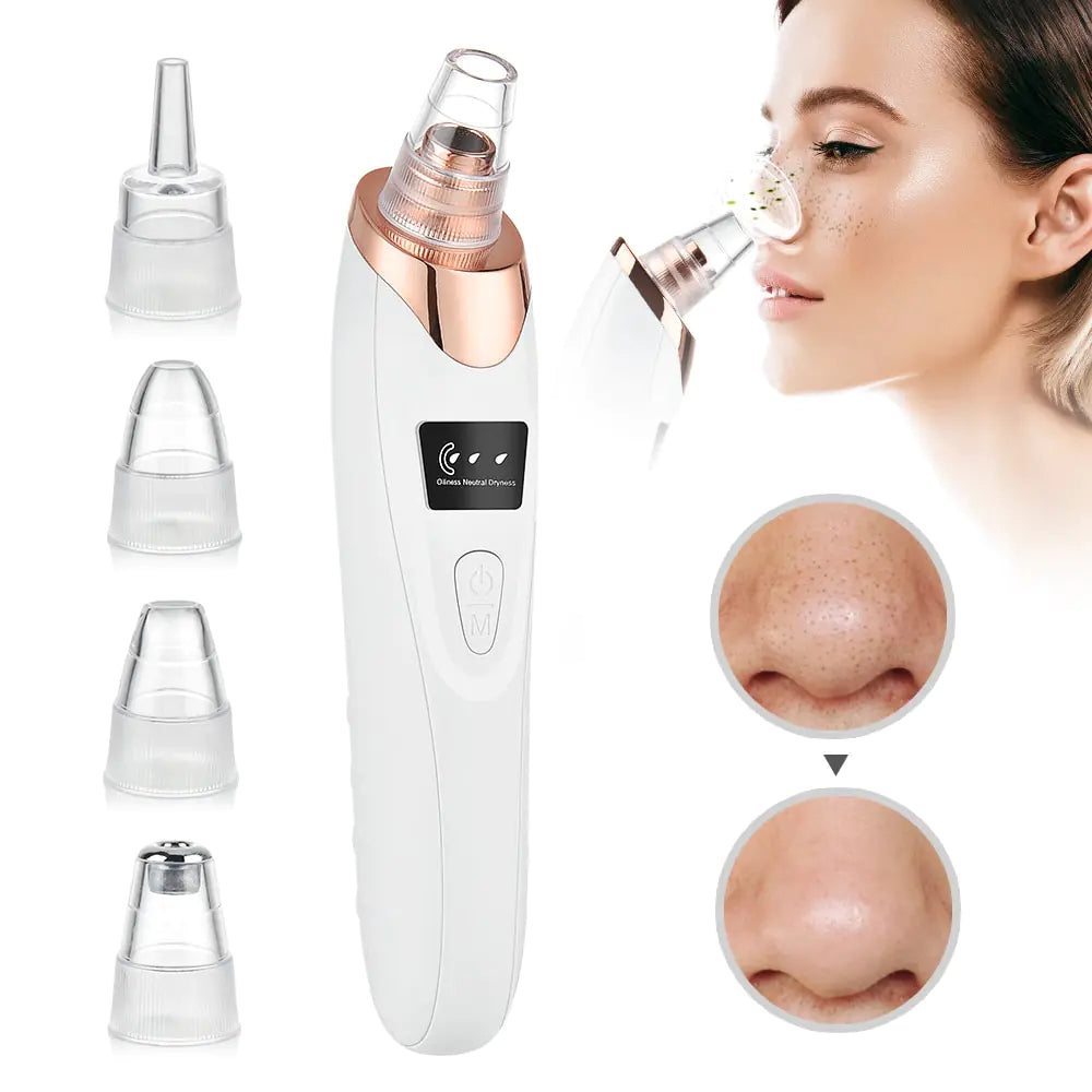 Electric blackhead remover